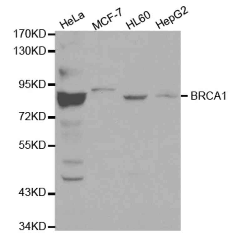 Western blot - BRCA1 Antibody from Signalway Antibody (32016) - Antibodies.com