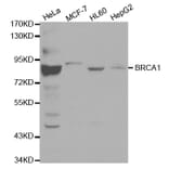 Western blot - BRCA1 Antibody from Signalway Antibody (32016) - Antibodies.com