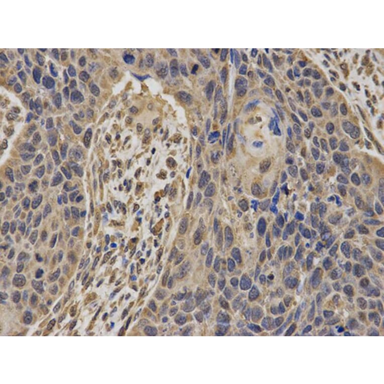Immunohistochemistry - BRCA1 Antibody from Signalway Antibody (32016) - Antibodies.com