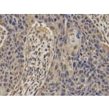 Immunohistochemistry - BRCA1 Antibody from Signalway Antibody (32016) - Antibodies.com