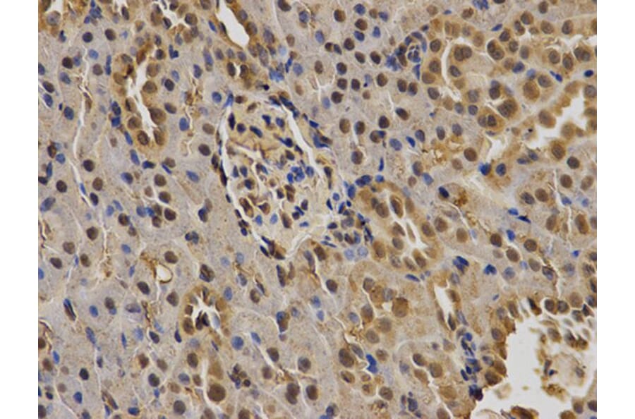 Immunohistochemistry - BRCA1 Antibody from Signalway Antibody (32016) - Antibodies.com