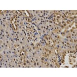 Immunohistochemistry - BRCA1 Antibody from Signalway Antibody (32016) - Antibodies.com