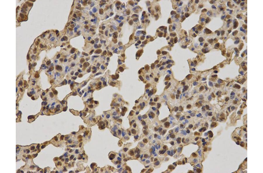 Immunohistochemistry - BRCA1 Antibody from Signalway Antibody (32016) - Antibodies.com