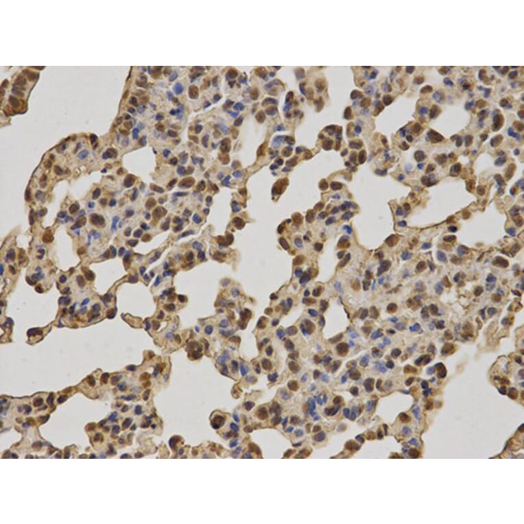 Immunohistochemistry - BRCA1 Antibody from Signalway Antibody (32016) - Antibodies.com