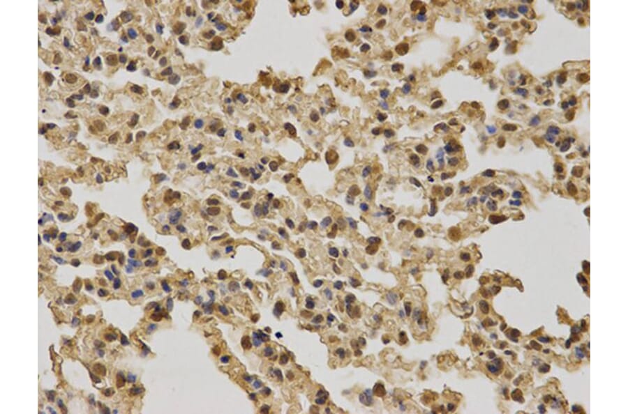 Immunohistochemistry - BRCA1 Antibody from Signalway Antibody (32016) - Antibodies.com