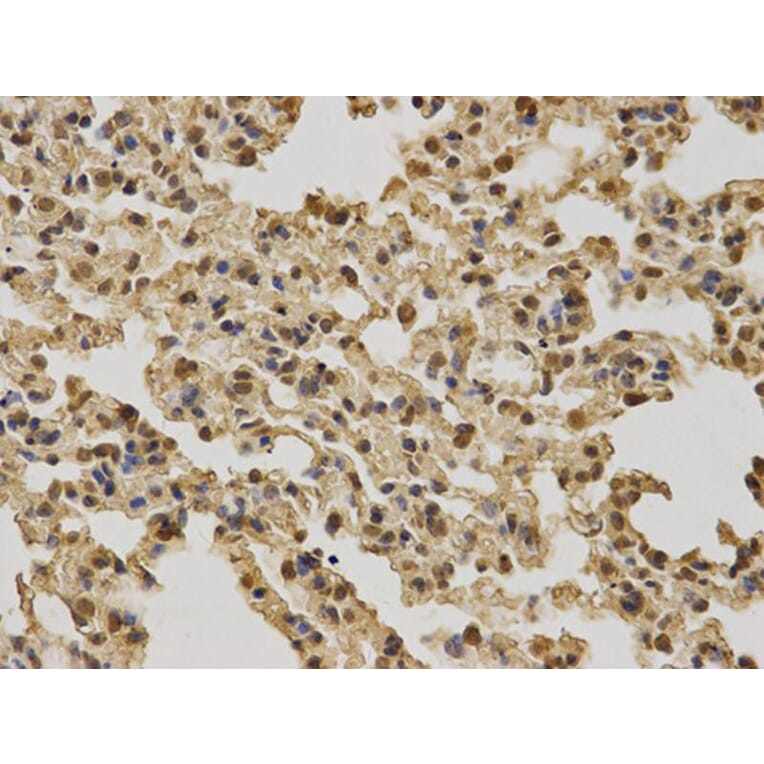 Immunohistochemistry - BRCA1 Antibody from Signalway Antibody (32016) - Antibodies.com