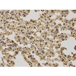 Immunohistochemistry - BRCA1 Antibody from Signalway Antibody (32016) - Antibodies.com