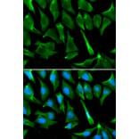 Immunofluorescence - BRCA1 Antibody from Signalway Antibody (32016) - Antibodies.com