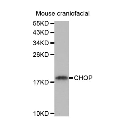 Western blot - DDIT3 Antibody from Signalway Antibody (32021) - Antibodies.com