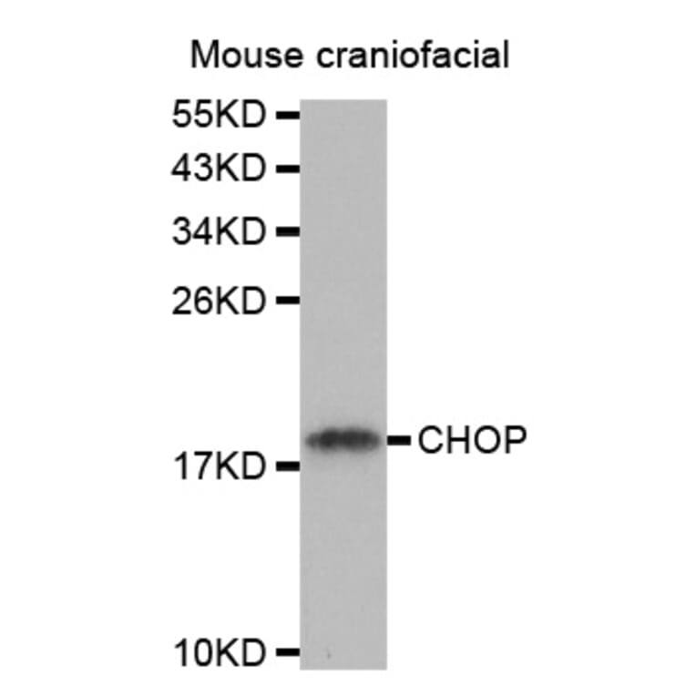 Western blot - DDIT3 Antibody from Signalway Antibody (32021) - Antibodies.com