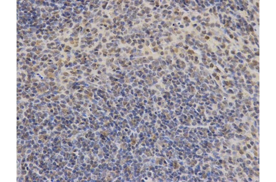 Immunohistochemistry - DDIT3 Antibody from Signalway Antibody (32021) - Antibodies.com