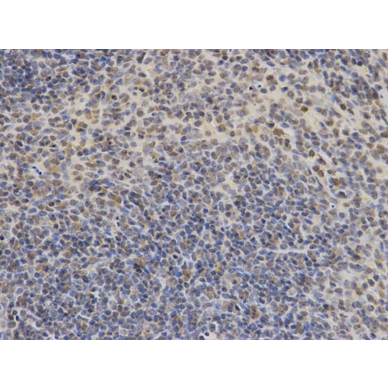 Immunohistochemistry - DDIT3 Antibody from Signalway Antibody (32021) - Antibodies.com
