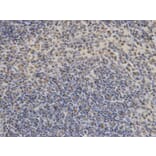 Immunohistochemistry - DDIT3 Antibody from Signalway Antibody (32021) - Antibodies.com
