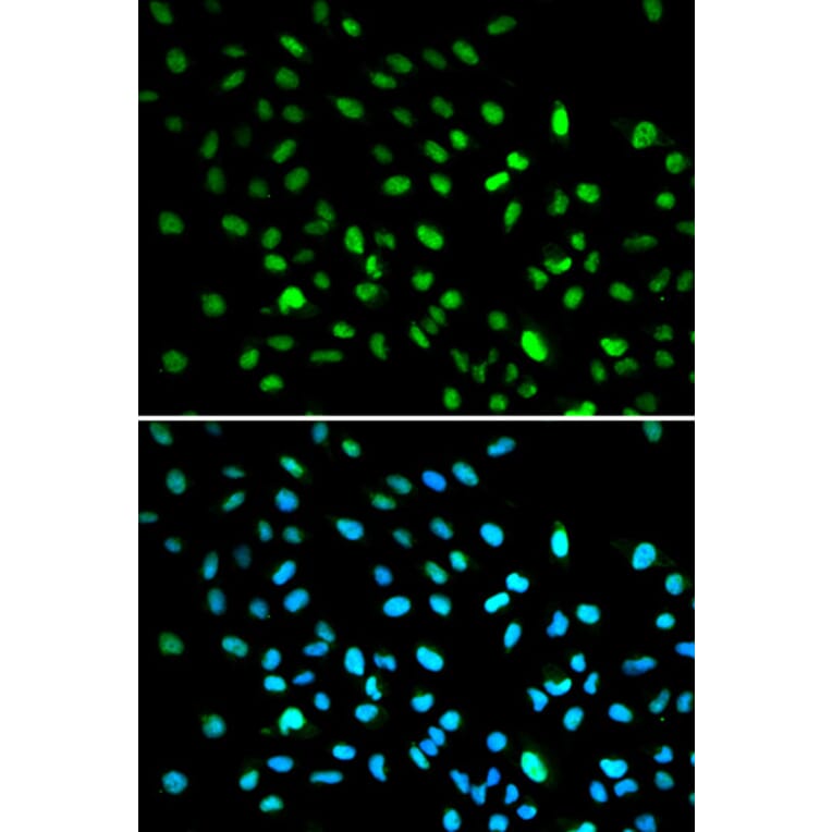 Immunofluorescence - DDIT3 Antibody from Signalway Antibody (32021) - Antibodies.com