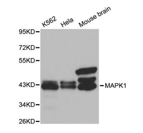 Western blot - MAPK1 Antibody from Signalway Antibody (32028) - Antibodies.com