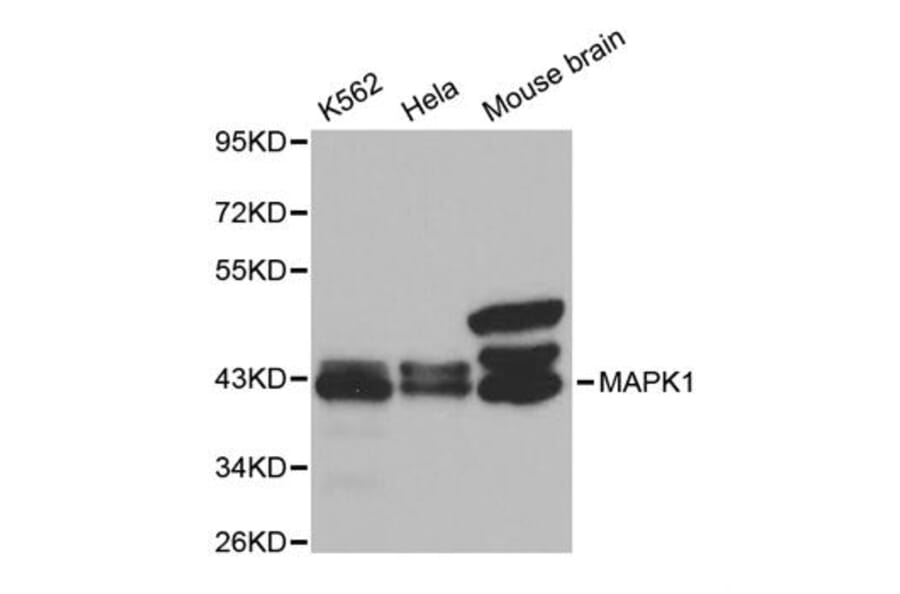 Western blot - MAPK1 Antibody from Signalway Antibody (32028) - Antibodies.com