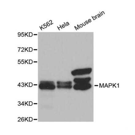 Western blot - MAPK1 Antibody from Signalway Antibody (32028) - Antibodies.com