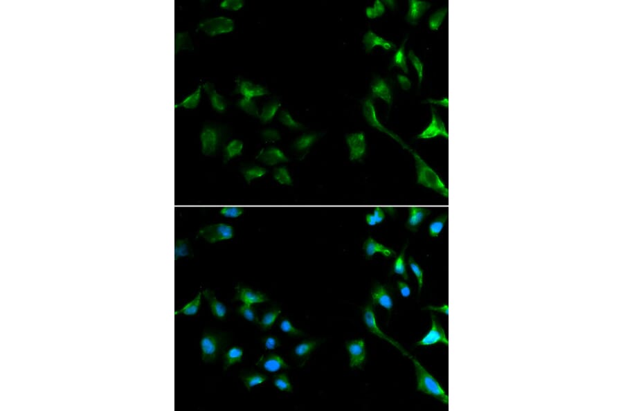 Immunofluorescence - MAPK1 Antibody from Signalway Antibody (32028) - Antibodies.com