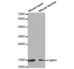 Western blot - FABP4 Antibody from Signalway Antibody (32030) - Antibodies.com