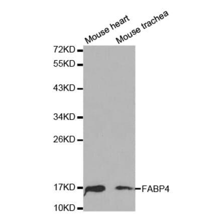 Western blot - FABP4 Antibody from Signalway Antibody (32030) - Antibodies.com