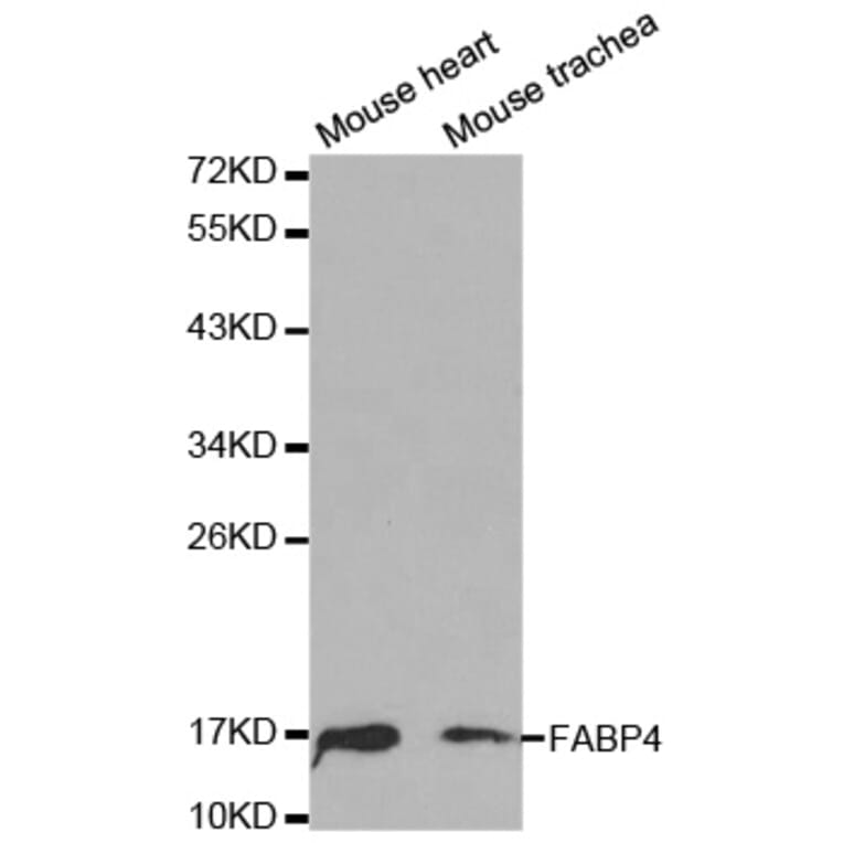Western blot - FABP4 Antibody from Signalway Antibody (32030) - Antibodies.com