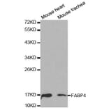 Western blot - FABP4 Antibody from Signalway Antibody (32030) - Antibodies.com