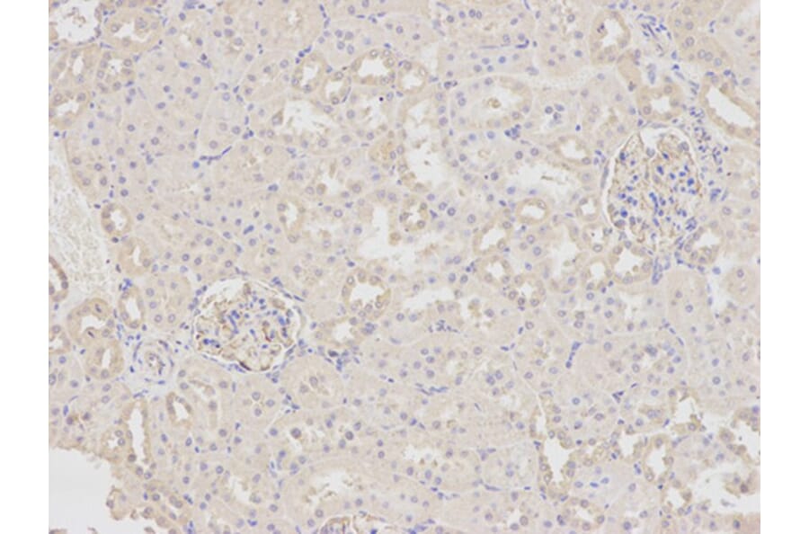 Immunohistochemistry - FABP4 Antibody from Signalway Antibody (32030) - Antibodies.com