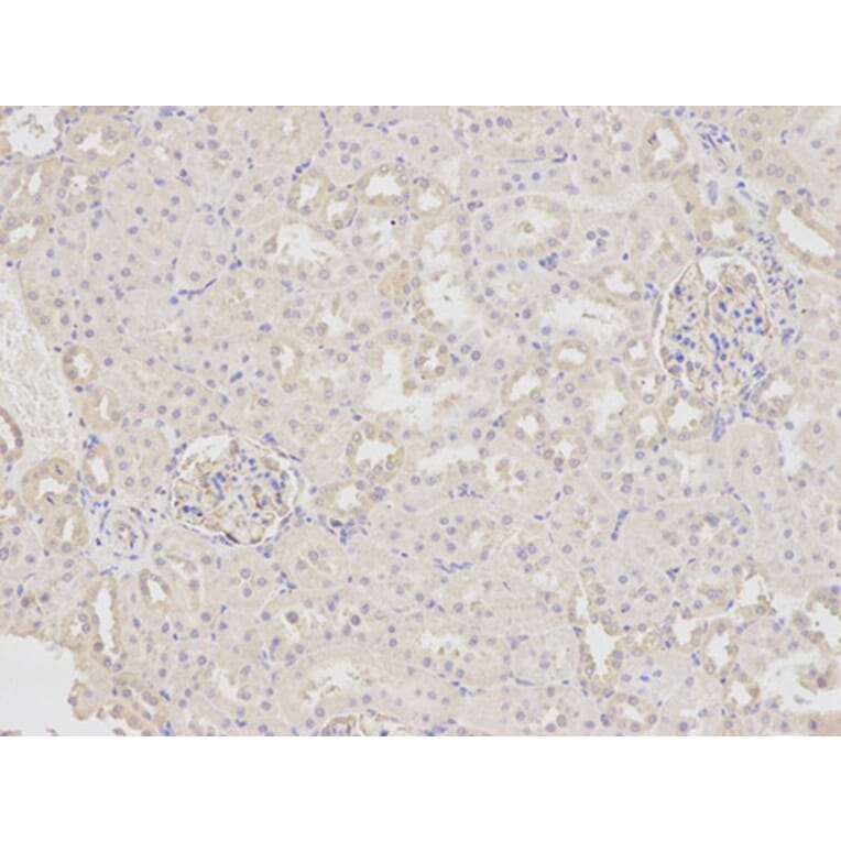 Immunohistochemistry - FABP4 Antibody from Signalway Antibody (32030) - Antibodies.com