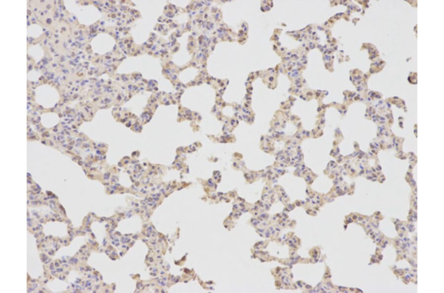 Immunohistochemistry - FABP4 Antibody from Signalway Antibody (32030) - Antibodies.com