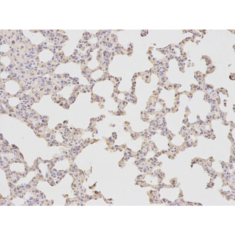 Immunohistochemistry - FABP4 Antibody from Signalway Antibody (32030) - Antibodies.com