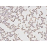 Immunohistochemistry - FABP4 Antibody from Signalway Antibody (32030) - Antibodies.com