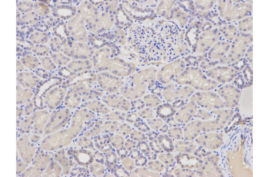 Immunohistochemistry - FABP4 Antibody from Signalway Antibody (32030) - Antibodies.com