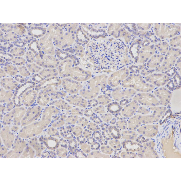 Immunohistochemistry - FABP4 Antibody from Signalway Antibody (32030) - Antibodies.com