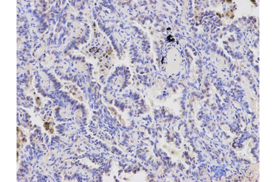 Immunohistochemistry - FABP4 Antibody from Signalway Antibody (32030) - Antibodies.com