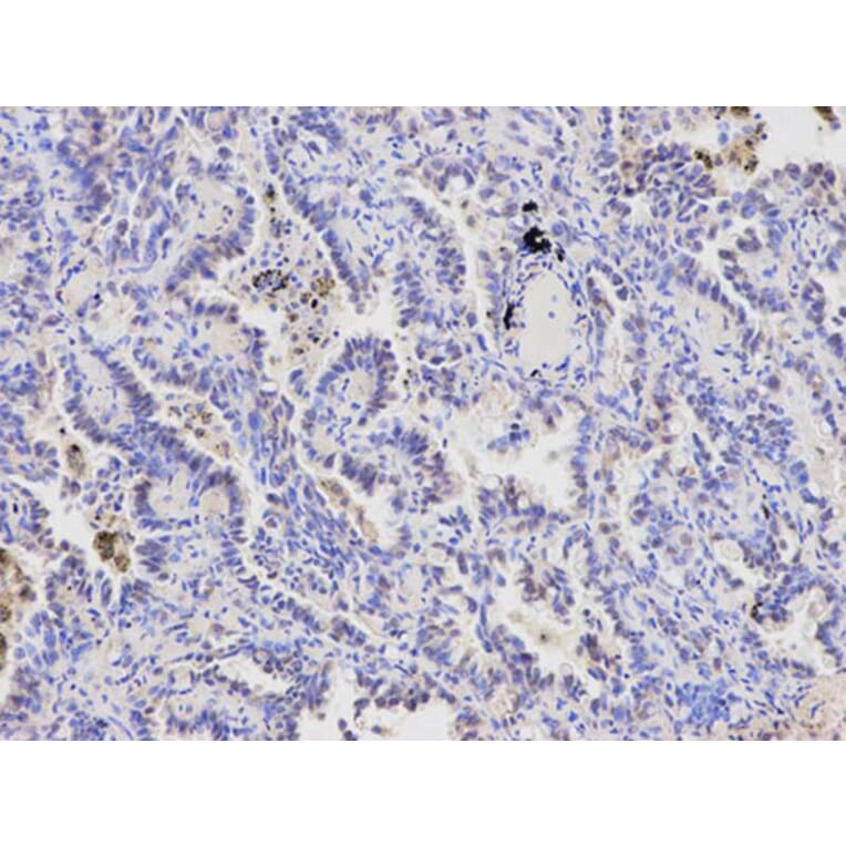 Immunohistochemistry - FABP4 Antibody from Signalway Antibody (32030) - Antibodies.com