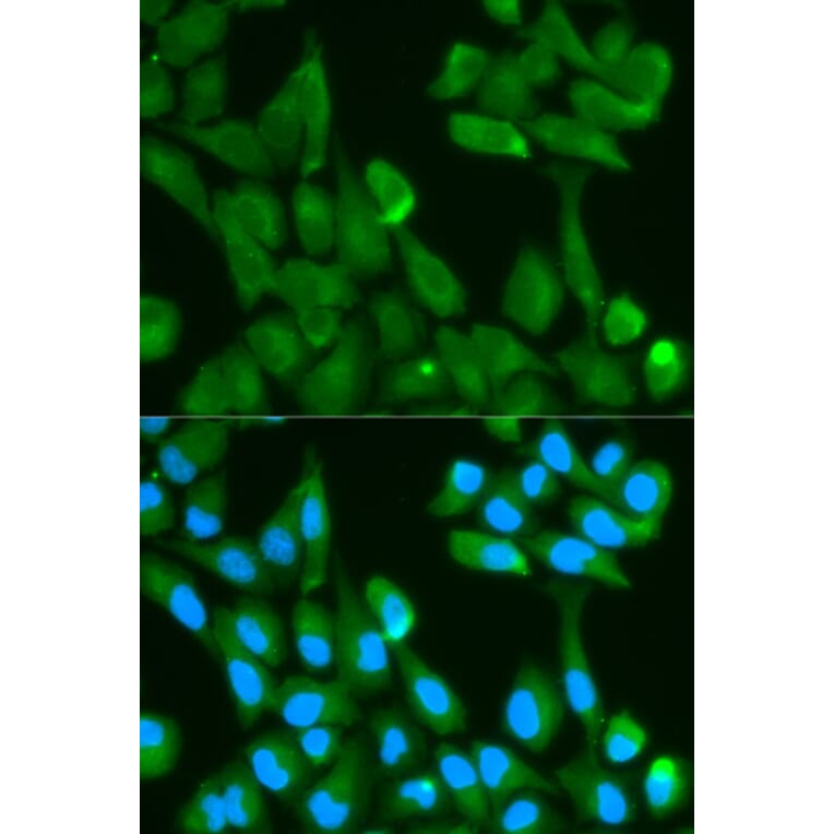 Immunofluorescence - FABP4 Antibody from Signalway Antibody (32030) - Antibodies.com