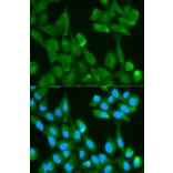 Immunofluorescence - FABP4 Antibody from Signalway Antibody (32030) - Antibodies.com