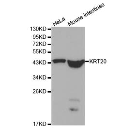 Western blot - KRT20 Antibody from Signalway Antibody (32041) - Antibodies.com