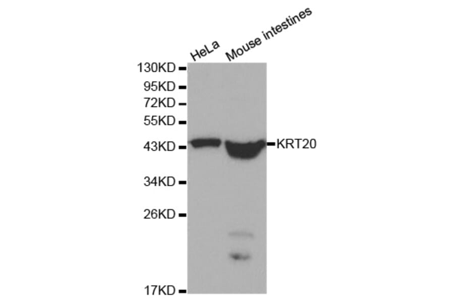 Western blot - KRT20 Antibody from Signalway Antibody (32041) - Antibodies.com