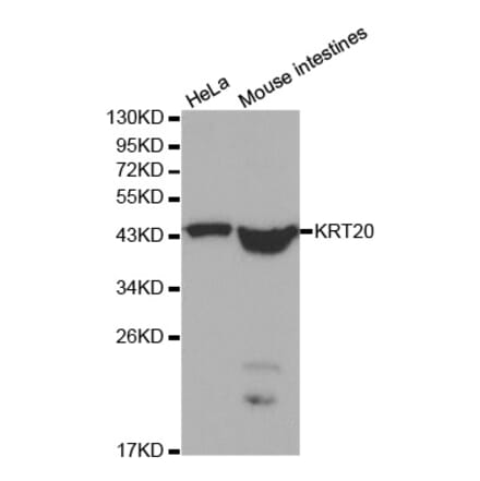 Western blot - KRT20 Antibody from Signalway Antibody (32041) - Antibodies.com