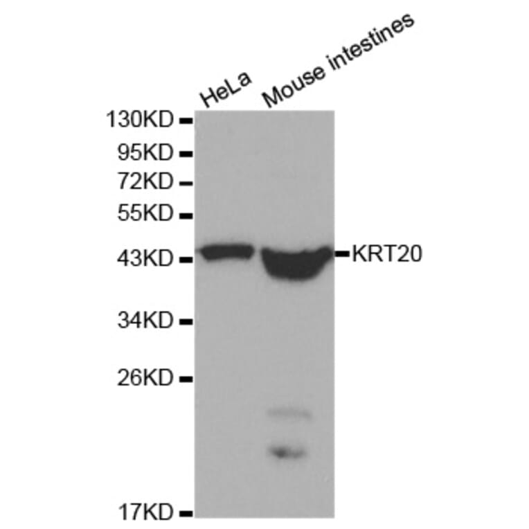 Western blot - KRT20 Antibody from Signalway Antibody (32041) - Antibodies.com