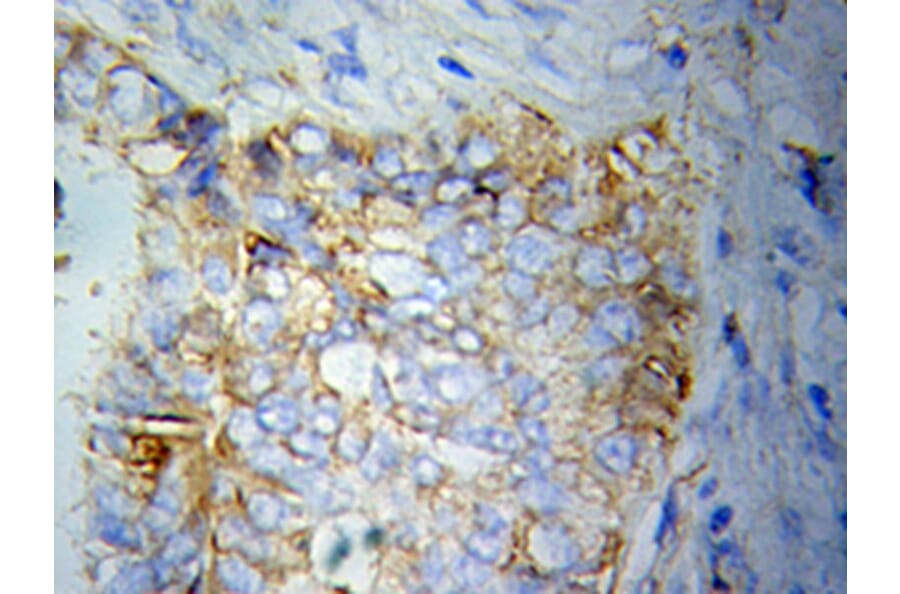 Immunohistochemistry - KRT20 Antibody from Signalway Antibody (32041) - Antibodies.com