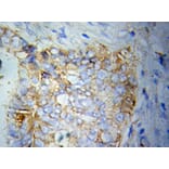 Immunohistochemistry - KRT20 Antibody from Signalway Antibody (32041) - Antibodies.com