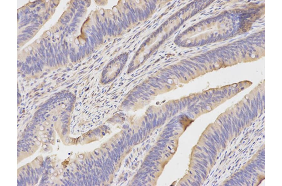 Immunohistochemistry - KRT20 Antibody from Signalway Antibody (32041) - Antibodies.com