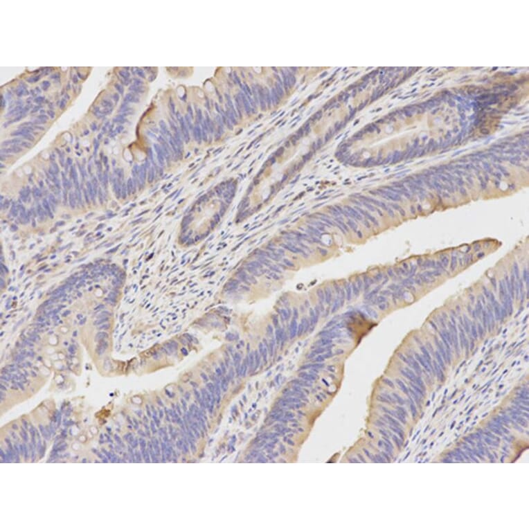 Immunohistochemistry - KRT20 Antibody from Signalway Antibody (32041) - Antibodies.com