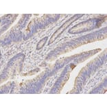 Immunohistochemistry - KRT20 Antibody from Signalway Antibody (32041) - Antibodies.com