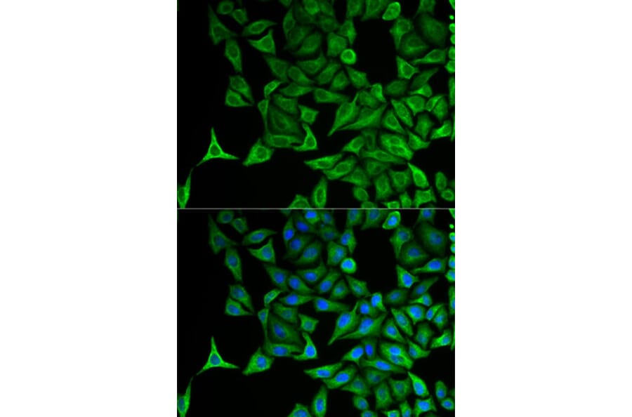 Immunofluorescence - KRT20 Antibody from Signalway Antibody (32041) - Antibodies.com