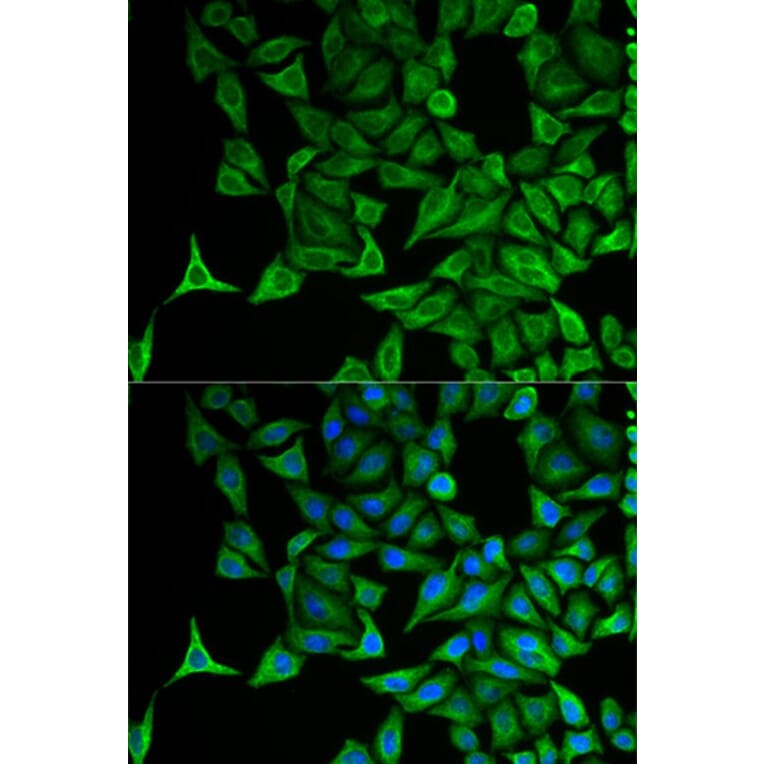 Immunofluorescence - KRT20 Antibody from Signalway Antibody (32041) - Antibodies.com