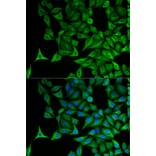 Immunofluorescence - KRT20 Antibody from Signalway Antibody (32041) - Antibodies.com