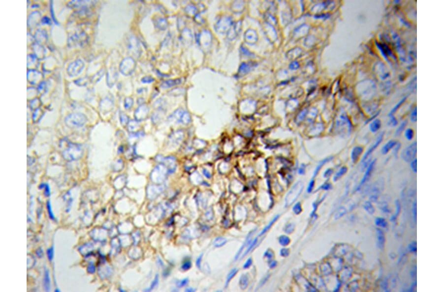 Immunohistochemistry - NAMPT Antibody from Signalway Antibody (32047) - Antibodies.com